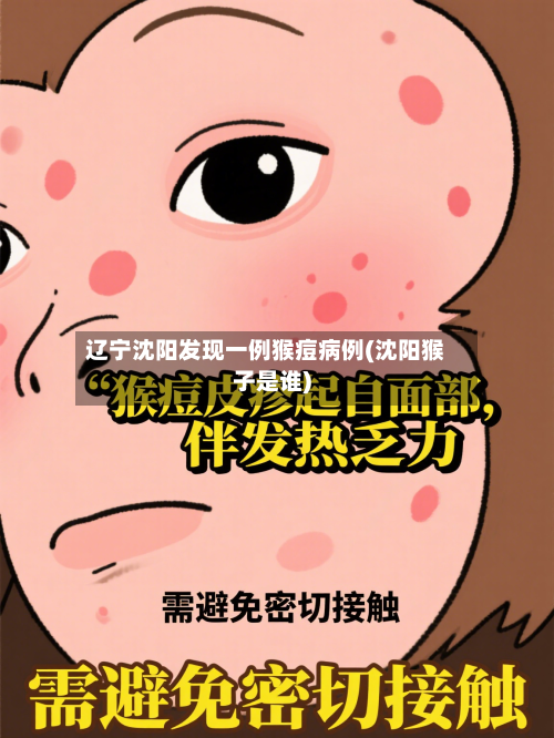辽宁沈阳发现一例猴痘病例(沈阳猴子是谁)-第2张图片