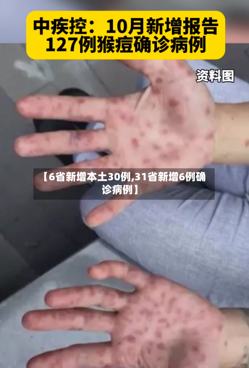 【6省新增本土30例,31省新增6例确诊病例】-第2张图片