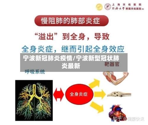 宁波新冠肺炎疫情/宁波新型冠状肺炎最新-第3张图片