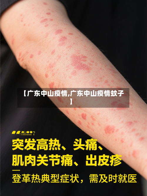 【广东中山疫情,广东中山疫情蚊子】-第2张图片