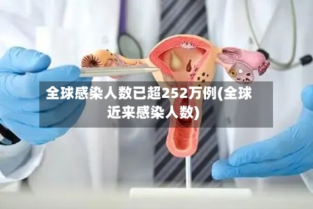 全球感染人数已超252万例(全球近来感染人数)-第2张图片
