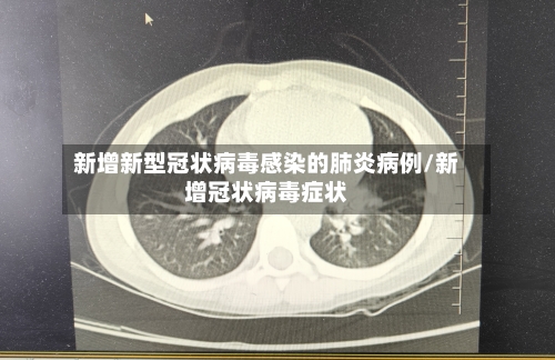 新增新型冠状病毒感染的肺炎病例/新增冠状病毒症状-第2张图片